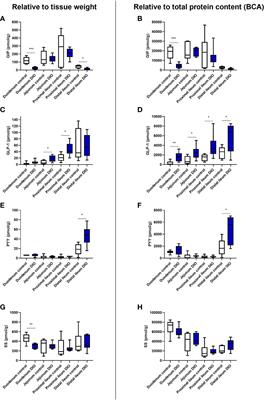 Glucose- and Bile Acid-Stimulated Secretion of Gut Hormones in the Isolated Perfused Intestine Is Not Impaired in Diet-Induced Obese Mice